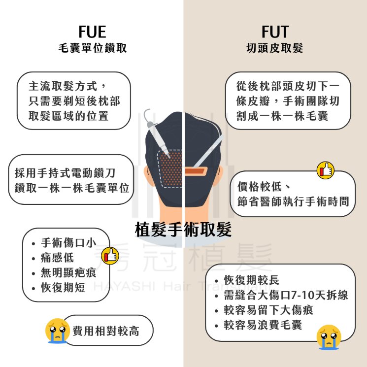 FUE FUT切頭皮 植髮重點比較