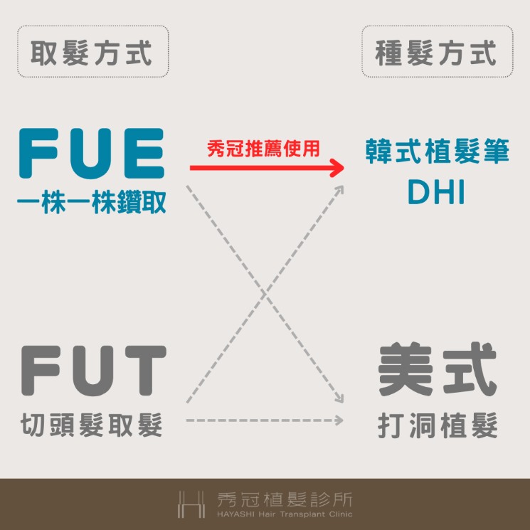 秀冠推薦植髮用FUE及韓式植髮筆方式