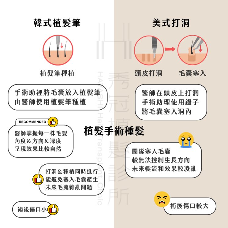 種髮方式比較-美式打洞、韓式植髮筆